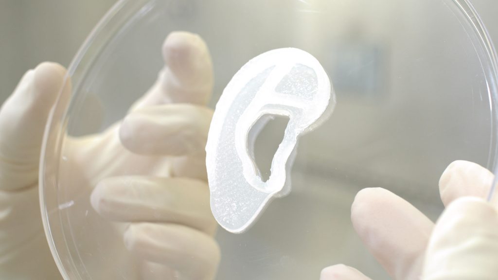 oreille imprimée en 3D