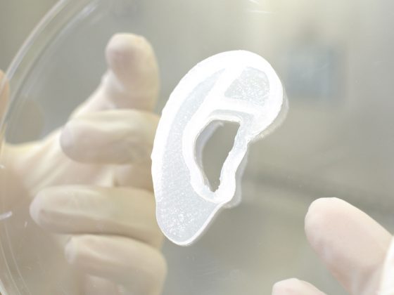 oreille imprimée en 3D